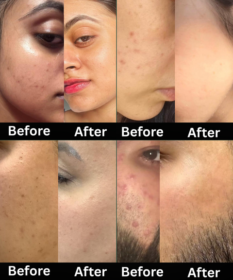 Holistic Face Kit