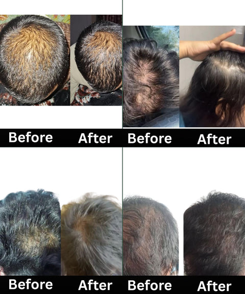 Hair Growth Combo